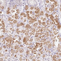Invitrogen ITPK1 Polyclonal Antibody 100 &mu;L; Unconjugated:Antibodies,
