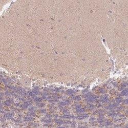 Invitrogen ITPK1 Polyclonal Antibody 100 &mu;L; Unconjugated:Antibodies,
