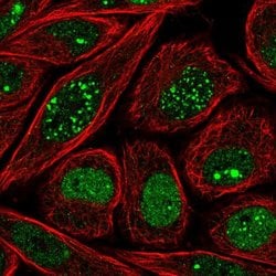 Invitrogen HEN2 Polyclonal Antibody 100 &mu;L; Unconjugated:Antibodies,