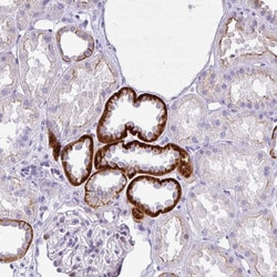Invitrogen HEN2 Polyclonal Antibody 100 &mu;L; Unconjugated:Antibodies,