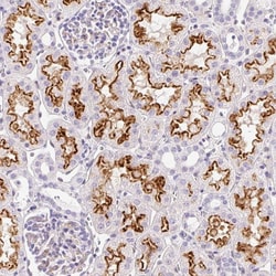 Invitrogen ASB4 Polyclonal Antibody 100 &mu;L; Unconjugated:Antibodies,