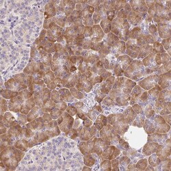 Invitrogen RPL18A Polyclonal Antibody 100 &mu;L | Buy Online | Invitrogen&trade; | Fisher Scientific