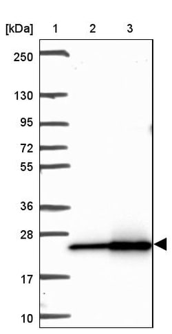 Invitrogen RPL18A Polyclonal Antibody 100 &mu;L | Buy Online | Invitrogen&trade; | Fisher Scientific
