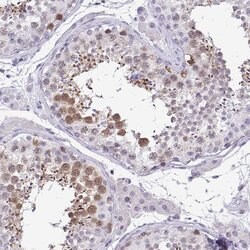 Invitrogen Cdc20 Polyclonal Antibody 100 &mu;L; Unconjugated:Antibodies,