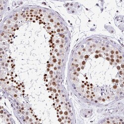 Invitrogen DR1 Polyclonal Antibody 100 &mu;L; Unconjugated:Antibodies,