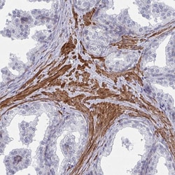 Invitrogen NEURL4 Polyclonal Antibody 100 &mu;L; Unconjugated:Antibodies,