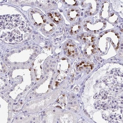 Invitrogen ATP6V0D2 Polyclonal Antibody 100 &mu;L; Unconjugated:Antibodies,