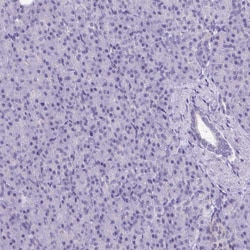 Invitrogen ATP6V0D2 Polyclonal Antibody 100 &mu;L; Unconjugated:Antibodies,