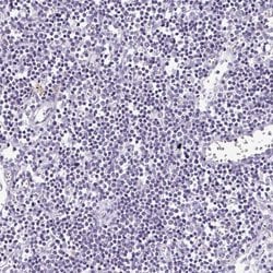 Invitrogen ATP6V0D2 Polyclonal Antibody 100 &mu;L; Unconjugated:Antibodies,