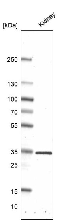 Invitrogen ATP6V0D2 Polyclonal Antibody 100 &mu;L | Buy Online | Invitrogen&trade; | Fisher Scientific