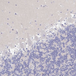 Invitrogen ZNF561 Polyclonal Antibody 100 &mu;L | Buy Online | Invitrogen&trade; | Fisher Scientific