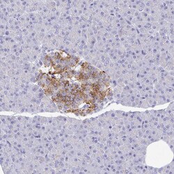 Invitrogen ZNF561 Polyclonal Antibody 100 &mu;L | Buy Online | Invitrogen&trade; | Fisher Scientific