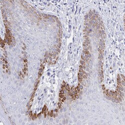 Invitrogen ZNF561 Polyclonal Antibody 100 &mu;L | Buy Online | Invitrogen&trade; | Fisher Scientific