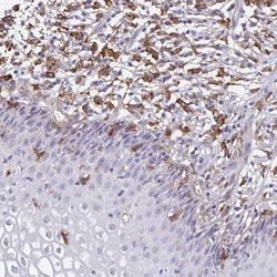 Invitrogen Tensin 3 Polyclonal Antibody 100 &mu;L | Buy Online | Invitrogen&trade; | Fisher Scientific