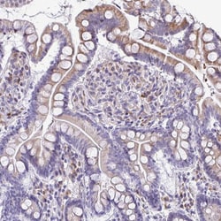 Invitrogen FIBCD1 Polyclonal Antibody 100 &mu;L; Unconjugated:Antibodies,