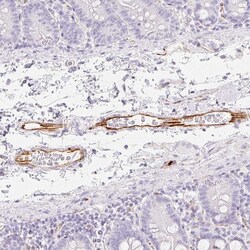 Invitrogen ZNF689 Polyclonal Antibody 100 &mu;L; Unconjugated:Antibodies,