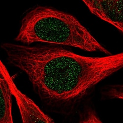 Invitrogen ZNF256 Polyclonal Antibody 100 &mu;L; Unconjugated:Antibodies,