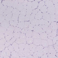 Invitrogen UPP1 Polyclonal Antibody 100 &mu;L; Unconjugated:Antibodies,