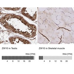 Invitrogen ZW10 Polyclonal Antibody 100 &mu;L; Unconjugated:Antibodies,