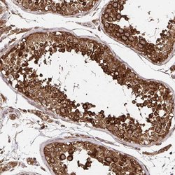 Invitrogen ZW10 Polyclonal Antibody 100 &mu;L; Unconjugated:Antibodies,