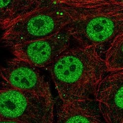 Invitrogen SYT10 Polyclonal Antibody 100 &mu;L; Unconjugated:Antibodies,