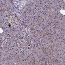 Invitrogen SYT10 Polyclonal Antibody 100 &mu;L; Unconjugated:Antibodies,