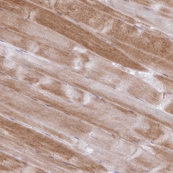 Invitrogen ZNF101 Polyclonal Antibody 100 &mu;L | Buy Online | Invitrogen&trade; | Fisher Scientific