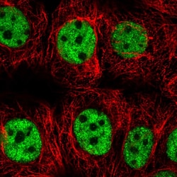 Invitrogen SNRPC Polyclonal Antibody 100 &mu;L | Buy Online | Invitrogen&trade; | Fisher Scientific