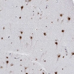 Invitrogen SNRPC Polyclonal Antibody 100 &mu;L | Buy Online | Invitrogen&trade; | Fisher Scientific