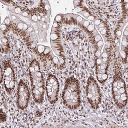 Invitrogen SNRPC Polyclonal Antibody 100 &mu;L | Buy Online | Invitrogen&trade; | Fisher Scientific
