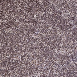 Invitrogen SNRPC Polyclonal Antibody 100 &mu;L | Buy Online | Invitrogen&trade; | Fisher Scientific