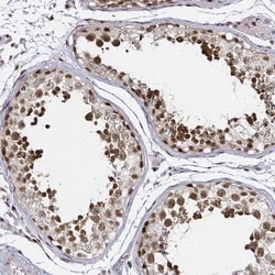 Invitrogen SNRPC Polyclonal Antibody 100 &mu;L | Buy Online | Invitrogen&trade; | Fisher Scientific