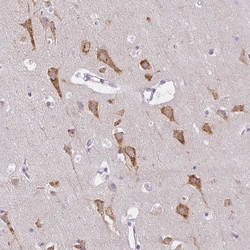 Invitrogen ZFYVE26 Polyclonal Antibody 100 &mu;L | Buy Online | Invitrogen&trade; | Fisher Scientific
