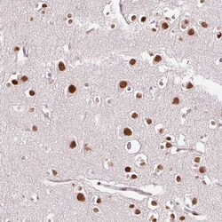 Invitrogen RIPPLY3 Polyclonal Antibody 100 &mu;L | Buy Online | Invitrogen&trade; | Fisher Scientific
