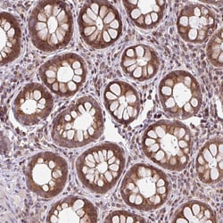 Invitrogen FIGNL1 Polyclonal Antibody 100 &mu;L; Unconjugated:Antibodies,