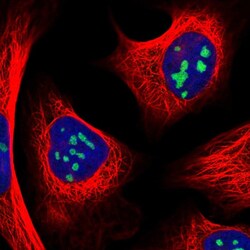 Invitrogen RRS1 Polyclonal Antibody 100 &mu;L; Unconjugated:Antibodies,