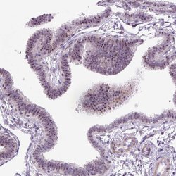 Invitrogen RRS1 Polyclonal Antibody 100 &mu;L; Unconjugated:Antibodies,