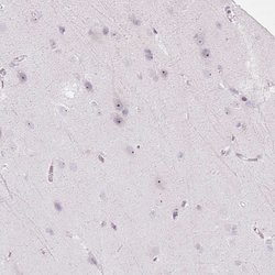 Invitrogen RRS1 Polyclonal Antibody 100 &mu;L; Unconjugated:Antibodies,