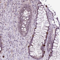 Invitrogen RRS1 Polyclonal Antibody 100 &mu;L; Unconjugated:Antibodies,
