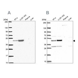 Invitrogen RRS1 Polyclonal Antibody 100 &mu;L; Unconjugated:Antibodies,