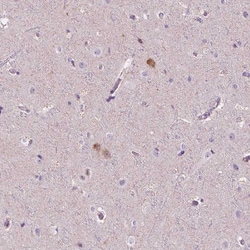 Invitrogen NOS1AP Polyclonal Antibody 100 &mu;L; Unconjugated:Antibodies,