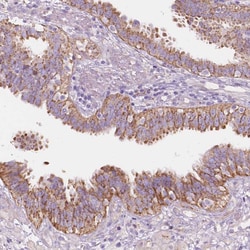 Invitrogen NOS1AP Polyclonal Antibody 100 &mu;L; Unconjugated:Antibodies,