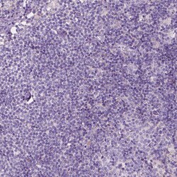 Invitrogen NOS1AP Polyclonal Antibody 100 &mu;L; Unconjugated:Antibodies,