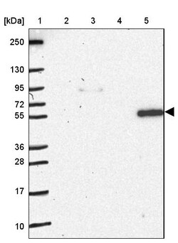 Invitrogen NOS1AP Polyclonal Antibody 100 &mu;L; Unconjugated:Antibodies,