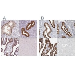Invitrogen ALP Polyclonal Antibody 100 &mu;L; Unconjugated:Antibodies,