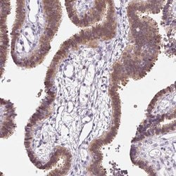 Invitrogen ALP Polyclonal Antibody 100 &mu;L; Unconjugated:Antibodies,