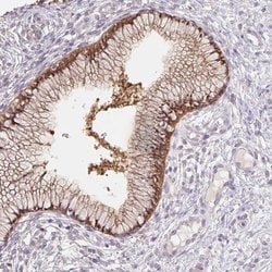 Invitrogen ALP Polyclonal Antibody 100 &mu;L; Unconjugated:Antibodies,
