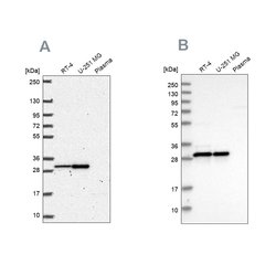 Invitrogen MRPL28 Polyclonal Antibody 100 &mu;L; Unconjugated:Antibodies,