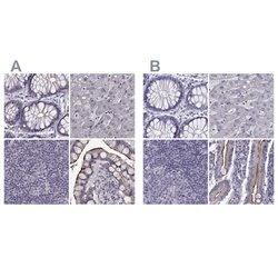 Invitrogen SLC28A2 Polyclonal Antibody 100 &mu;L; Unconjugated:Antibodies,