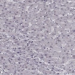 Invitrogen SLC28A2 Polyclonal Antibody 100 &mu;L; Unconjugated:Antibodies,
